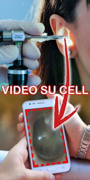 videosucell